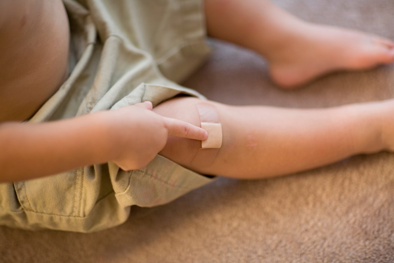 Child's Knee with Band-Aid